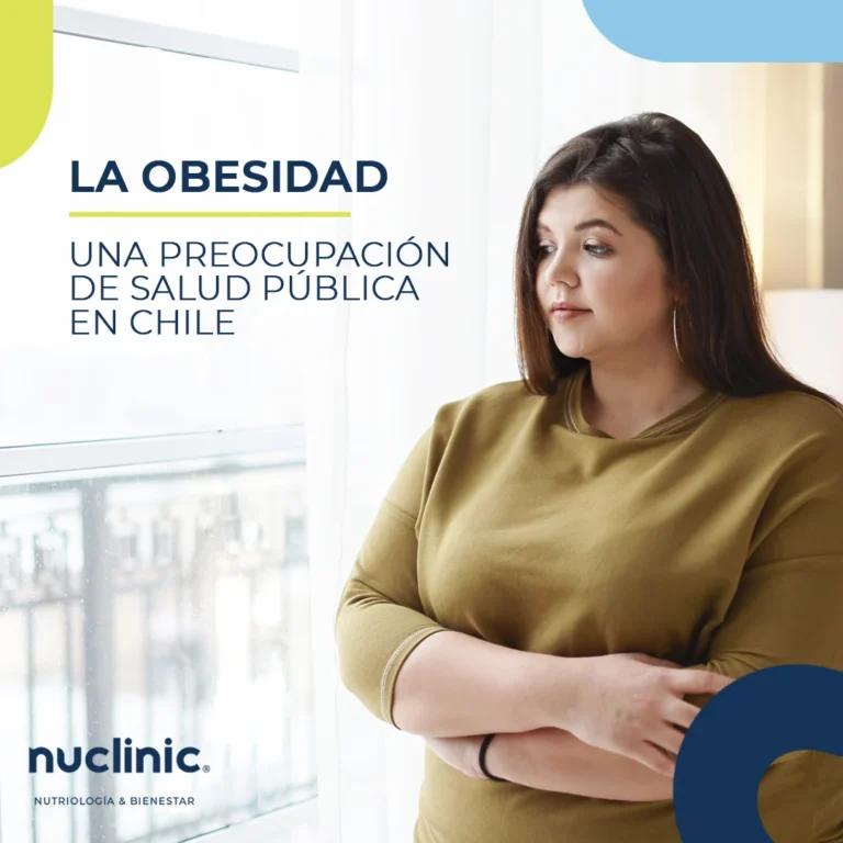La obesidad una preocupación de salud pública en chile